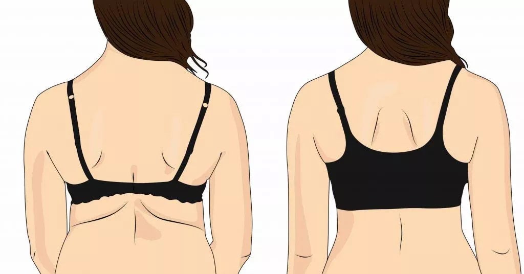 Back (Bra Line)  Cleanse and Shape Melbourne
